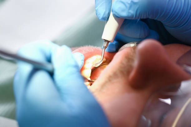 Best Weekend Emergency Dentist in Lanse, MI