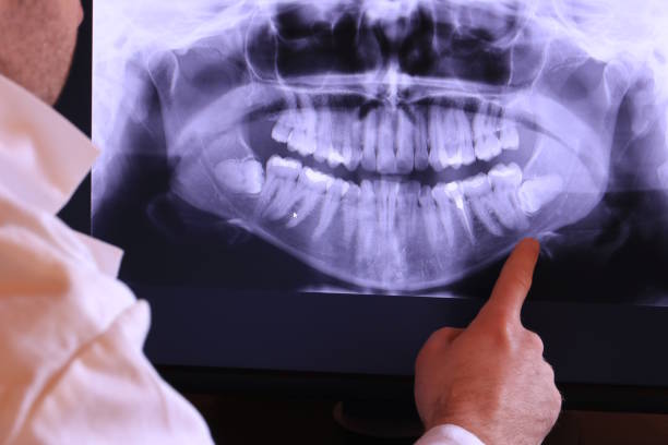 Best Emergency Dental Surgery in Lanse, MI
