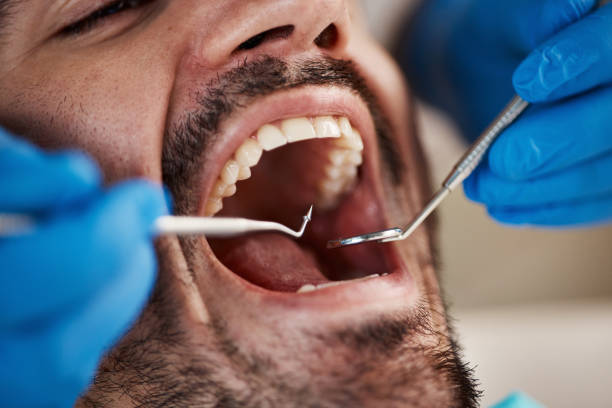 Best Urgent Dental Care in Lanse, MI