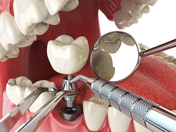Best After-Hours Emergency Dentist in Lanse, MI